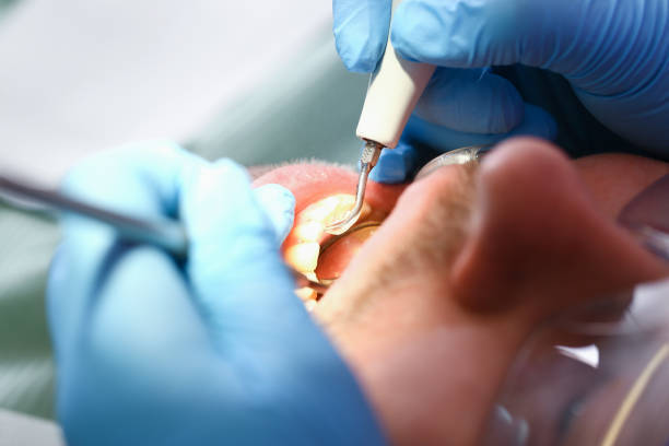 Best After-Hours Emergency Dentist in Churchville, NY