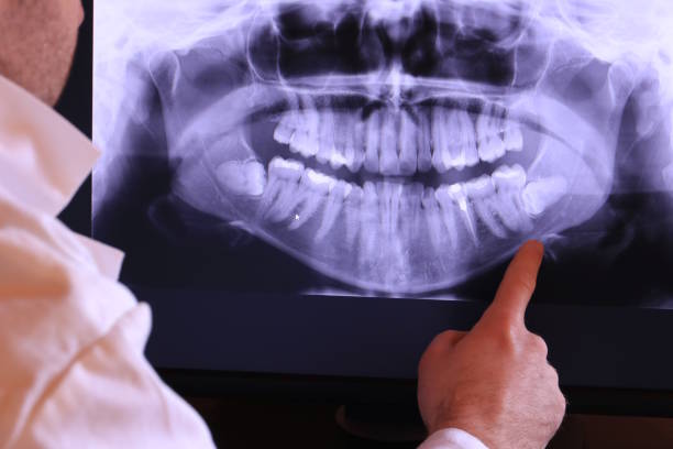 Best Emergency Broken Tooth Repair in Churchville, NY