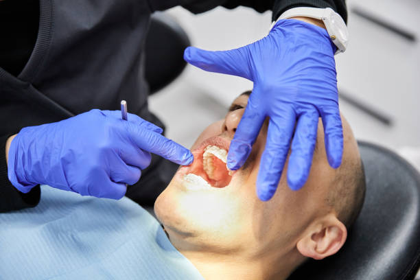 Best Emergency Treatment for Toothache in Churchville, NY