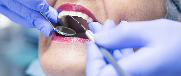Best Emergency Dental Surgery in Churchville, NY